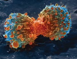 Dzieląca się komórka raka płuc (zdj. NIH).